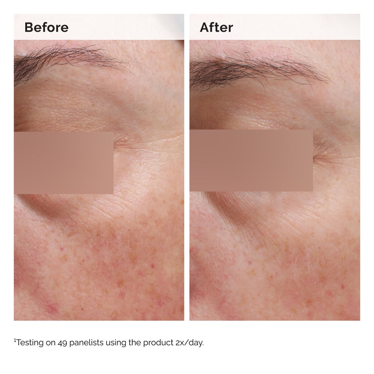 5% Face and Body Emulsion - Clean Scalp