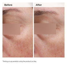 5% Face and Body Emulsion - Clean Scalp