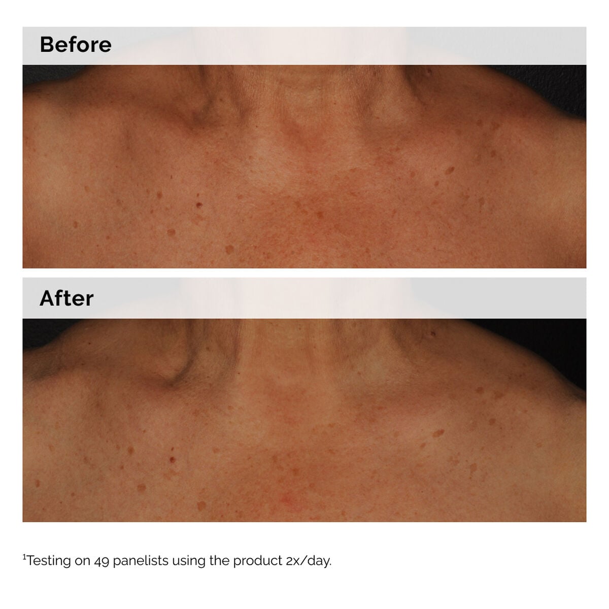 5% Face and Body Emulsion - Clean Scalp