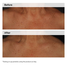5% Face and Body Emulsion - Clean Scalp