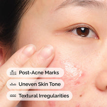 Aloe 2% + NAG 2% Solution - Daily Glow