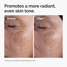 Acid 7% Exfoliating Toner - Classic Pick