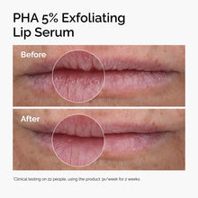 PHA 5% Exfoliating Lip Serum - Fresh Tint